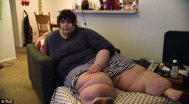 Improved: Seven months into her journey, Amber has lost 92lbs and dropped a lot of fluid from her legs (pictured)