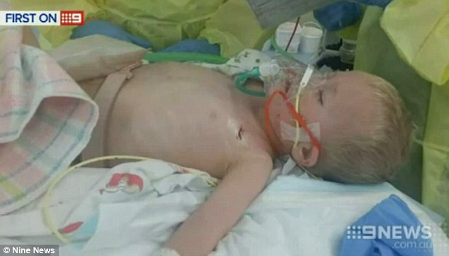 The condition affects one in 4,000 children, and was picked up very early on in Ms Cornish when she had her 14 week scan