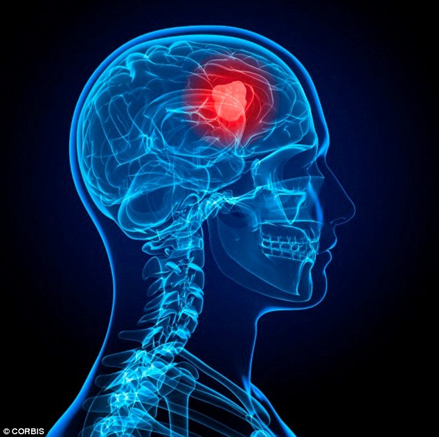 And the researchers discovered the treatment was able to kill brain cancer cells, pictured