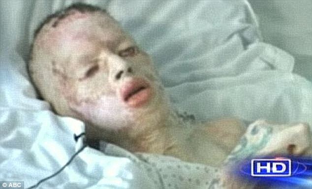 Disposition: Shortly before he died, Middleton gave a videotaped deposition in which he accused Collins for the first time of sexually assaulting him two weeks before the attack