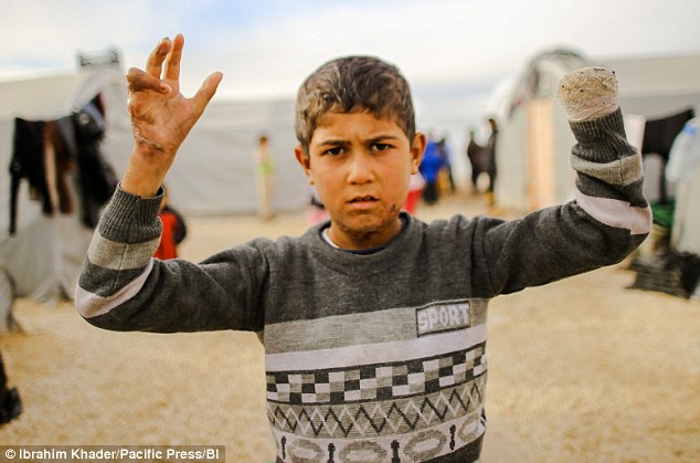 Refugee Shyar Ahmad, 14, is one of the children who has been badly wounded due to the war with ISIS militants - another problem highlighted in the report