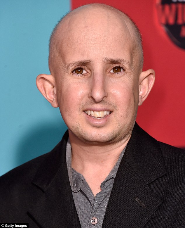 Horror series: Ben, shown in October 2014 in Hollywood, portrayed Meep in the American Horror Story: Freak Show