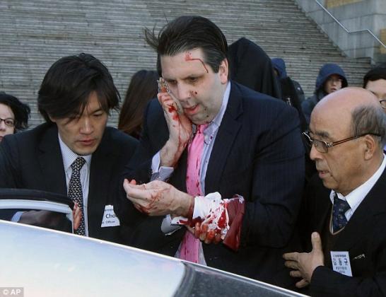 U.S. Ambassador to South Korea Mark Lippert hospitalized after being attacked by razor-blade wielding man during lecture