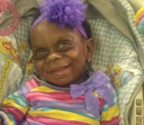 ‘She is a human being': Mother hits back at trolls taunting sick toddler